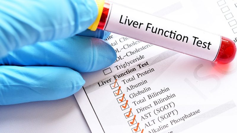 Understanding the Importance of Liver Function Tests