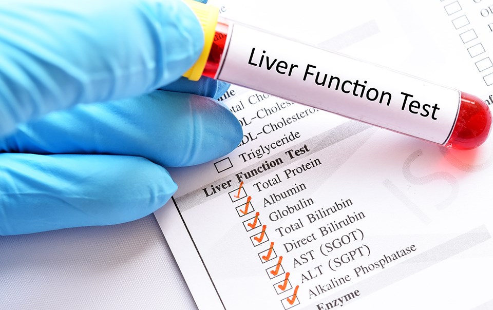 Understanding the Importance of Liver Function Tests